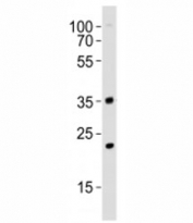 Western blot analysis of lysate from mouse NIH3T3 cell line using WDR5 antibody at 1:1000. Predicted molecular weight ~36 kDa.