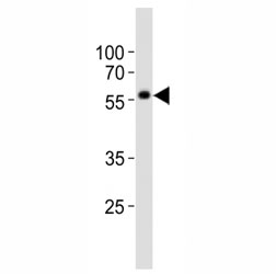 Western blot analysis of lysate from NCCIT cell line using KLF4 antibody at 1:1000. Predicted molecular weight: 50-60 kDa + ~75 kDa