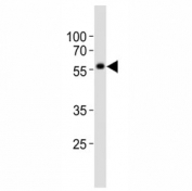 Western blot analysis of lysate from NCCIT cell line using KLF4 antibody at 1:1000. Predicted molecular weight: 50-60 kDa + possible ~75 kDa (phosphorylated form).