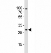 Western blot analysis of lysate from mouse brain tissue lysate using Olig1 antibody diluted at 1:1000. Predicted size 25~35 kDa