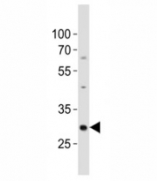 Western blot analysis of lysate from mouse kidney tissue lysate using Hes1 antibody diluted at 1:500. Predicted molecular weight: 30-35 kDa.