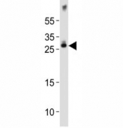 Western blot analysis of lysate from mouse brain tissue lysate using Olig1 antibody diluted at 1:1000. Predicted size 25~35 kDa
