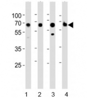 Western blot analysis of lysate from 1) human kidney, 2) mouse kidney, 3) mouse liver and 4) rat kidney tested with ACSM5 antibody at 1:1000. Predicted molecular weight ~65 kDa.