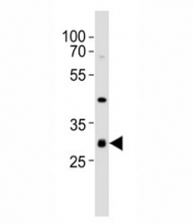 Western blot analysis of lysate from mouse NIH3T3 cell line using CDK5 antibody at 1:1000.