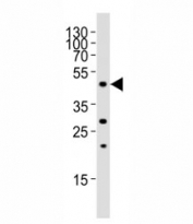 Western blot analysis of lysate from rat liver tissue, using FOXA2 antibody at 1:1000. Predicted molecular weight: 50 kDa.