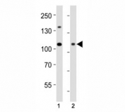Western blot analysis of lysate from (1) HeLa cell line and (2) human skeletal muscle tissue using Dnmt3a antibody at 1:1000. Predicted molecular weight: 100-130 kDa