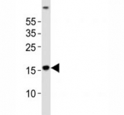 Western blot analysis of lysate from human brain tissue using LC3A antibody diluted at 1:1000.