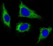 Immunofluorescent staining of PFA-fixed human HeLa cells with FGFR1 antibody (green) and DAPI nuclear stain (blue).