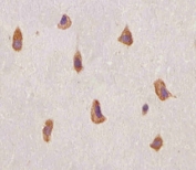 IHC staining of FFPE human brain with FGFR1 antibody. HIER: boil tissue sections in pH6, 10mM citrate buffer, for 20 min and allow to cool before testing.