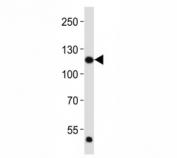 Western blot analysis of lysate from HeLa cell line using FGFR1 antibody at 1:2000. Predicted molecular weight: 75-160 kDa depending on glycosylation level.