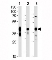Western blot analysis of mouse 1) kidney, 2) lung and 3) testis lysate using Epcam antibody