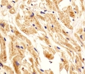 IHC analysis of FFPE human heart section using Integrin beta 8 antibody; Ab was diluted at 1:25.