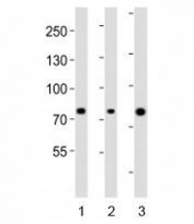 Western blot analysis of lysate from human 1) ovary, 2) placenta and 3) plasma lysate using Integrin beta 8 antibody diluted at 1:1000. Predicted molecular weight: 85/71 kDa (isoforms 1/2).