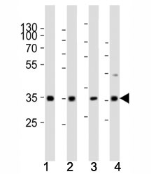 Western blot analysis of lysate from (1) human HeLa cell line, (2) mouse spleen, (3) rat lung, (4) rat stomach tissue using Cyclin D3 antibody at 1:1000.