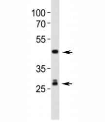 Western blot analysis of lysate from mouse liver tissue lysate using Shh antibody. Predicted molecular weight: 45/27/19 kDa (1)~