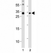 Western blot analysis of lysate from (1) mouse brain and (2) mouse skeletal muscle tissue lysate using Olig3 antibody at 1:1000.