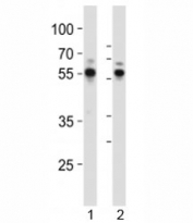 Western blot analysis of lysate from 1) Jurkat and 2) Molt-4 cell line using RUNX1 antibody at 1:1000.
