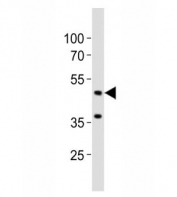 Western blot analysis of lysate from mouse brain tissue lysate using Eed antibody diluted at 1:1000. Predicted molecular weight: 50 kDa (isoform 1), 53 kDa (isoform 2), 46 kDa (isoform 3).