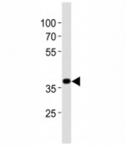 Western blot analysis of lysate from mouse stomach tissue lysate using Nkx2.5 antibody at 1:1000.