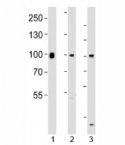 Western blot testing of Suz12 antibody at 1:1000 dilution. Lane 1: mouse F9 lysate; 2: human HeLa lysate; 3: human MCF-7 lysate; Observed molecular weight 83~95 kDa.
