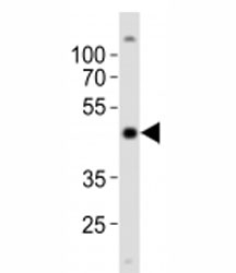 Western blot analysis of lysate from NCCIT cell line using POU5F1 antibody at 1:1000.