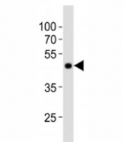 Western blot analysis of lysate from NCCIT cell line using POU5F1 antibody at 1:1000. Predicted molecular weight ~38/30kDa (isoform A/B).