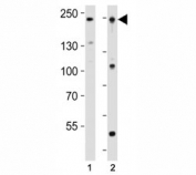 Western blot analysis of lysate from human K562 and mouse F9 cell line using Dnmt1 antibody at 1:1000. Predicted molecular weight: 180-200 kDa