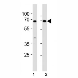 Western blot analysis of lysate from mouse (1) small intestine and (2) testis tissue lysate using Klf4 antibody at 1:1000. Predicted molecular weight: 50-60 kDa + ~75 kDa~