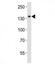 Western blot analysis of lysate from CEM cell line using SALL4 antibody diluted at 1:1000. Isoform A molecular weight: 112~165 kDa, Isoform B molecular weight: 65~95 kDa.