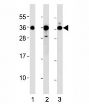 Western blot testing of DKK1 antibody at 1:2000 dilution. Lane 1: A549; 2: Jurkat; 3: NIH3T3 lysate; Predicted molecular weight: 26-40 kDa depending on glycosylation level.