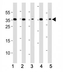 Western blot analysis of lysate from (1) A549, (2) HeLa, (3) HepG2, (4) Jurkat, (5) mouse NIH3T3 cell line using DKK1 antibody. Predicted molecular weight: 26-40 kDa depending on glycosylation level.~