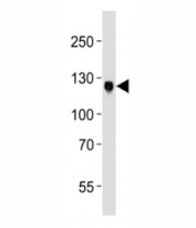 Western blot analysis of lysate from MCF-7 cell line using DDR1 antibody at 1:1000. Predicted molecular weight: 100~125KD.