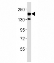 Western blot testing of ERBB4 antibody at 1:500 dilution + rat brain lysate; Predicted molecular weight: 147-180 kDa (precursor), 120, 80 kDa (cleaved forms).