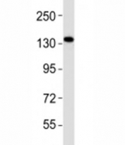 Western blot testing of Epha1 antibody at 1:2000 dilution + A549 lysate