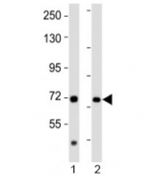 Western blot testing of AACS antibody at 1:2000 dilution. Lane 1: human kidney lysate; 2: rat brain lysate; Predicted band size : 75 kDa.