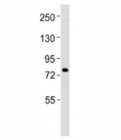 Western blot testing of ERCC2 antibody at 1:1000 dilution + K562 lysate