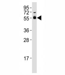 Western blot testing of SMAD3 antibody at 1:1000 dilution + mouse brain lysate; Observed molecular weight: 48~55 kDa.~