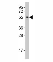 Western blot testing of SMAD3 antibody at 1:2000 dilution + rat brain lysate; Observed molecular weight: 48~55 kDa..