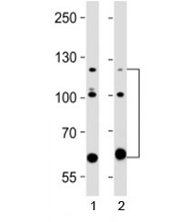 Western blot testing of ABL2 antibody at 1:2000 dilution. Lane 1: human A431 lysate; 2: human HeLa lysate; Expected molecular weight ~128 kDa, but routinely observed at 128-140 kDa with a possible ~61 kDa isoform.