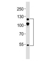 Western blot testing of ABL2 antibody at 1:500 dilution + mouse NIH3T3 lysate; Expected molecular weight ~128 kDa, but routinely observed at 128-140 kDa with a possible ~61 kDa isoform.