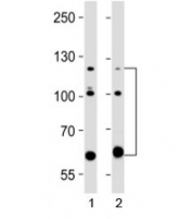 Western blot testing of ABL2 antibody at 1:2000 dilution. Lane 1: human A431 lysate; 2: human HeLa lysate; Expected molecular weight ~128 kDa, but routinely observed at 128-140 kDa with a possible ~61 kDa isoform.
