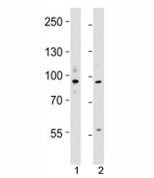 Western blot testing of UHRF1 antibody at 1:4000 dilution; Lane 1: KG-1 lysate, 2: MCF-7 lysate; Predicted molecular weight ~ 88 kDa.