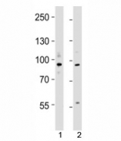 Western blot testing of UHRF1 antibody at 1:4000 dilution; Lane 1: KG-1 lysate, 2: MCF-7 lysate; Predicted/observed molecular weight: ~91/91-106kDa.