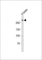 Western blot testing of LRRK2 antibody at 1:1000 dilution + human brain lysate