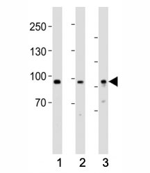 Western blot testing of PROX1 antibody at 1:1000 dilution. Lane 1: human heart lysate; 2: mouse brain lysate; 3: HepG2 lysate; Predicted molecular weight is 83 kDa, observed at 80-110 kDa.~