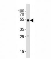 Western blot testing of Smad1 antibody at 1:1000 dilution + mouse skeletal muscle lysate; Predicted molecular weight: 52~60 kDa.