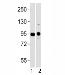 Western blot testing of Uhrf1 antibody at 1:1000 dilution + 1) mouse heart and 2) mouse thymus lysate. Predicted molecular weight ~ 88 kDa.