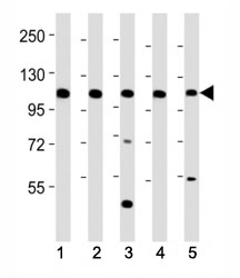 Western blot testing of Mertk antibody at 1:2000 dilution. Lane 1: mouse kidney lysate; 2: mouse liver lysate; 3: NIH3T3 lysate; 4: rat kidney lysate; 5: rat liver lysate; Predicted molecular weight: 110~205 kDa depending on glycosylation level~