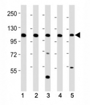 Western blot testing of Mertk antibody at 1:2000 dilution. Lane 1: mouse kidney lysate; 2: mouse liver lysate; 3: NIH3T3 lysate; 4: rat kidney lysate; 5: rat liver lysate; Predicted molecular weight: 110~205 kDa depending on glycosylation level