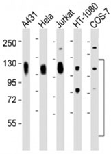 Western blot testing of LAMP antibody at 1:2000 dilution. Lane 1: A431; 2: HeLa; 3: Jurkat; 4: HT-1080; 5: COS-7 lysate. This heavily glycosylated protein of 417 amino acids is visualized at up to 140KD.